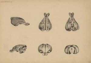 Атлас большого мозга человека и животных 1937 год - 01005159259_019.jpg
