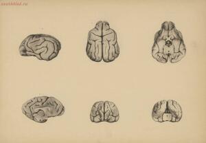 Атлас большого мозга человека и животных 1937 год - 01005159259_043.jpg