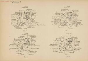 Атлас большого мозга человека и животных 1937 год - 01005159259_050.jpg