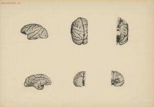 Атлас большого мозга человека и животных 1937 год - 01005159259_067.jpg