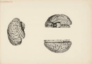 Атлас большого мозга человека и животных 1937 год - 01005159259_081.jpg