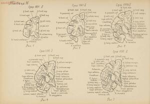 Атлас большого мозга человека и животных 1937 год - 01005159259_088.jpg