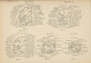 Атлас большого мозга человека и животных 1937 год - 01005159259_092.jpg