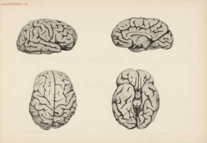 Атлас большого мозга человека и животных 1937 год - 01005159259_131.jpg