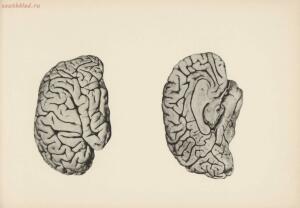 Атлас большого мозга человека и животных 1937 год - 01005159259_137.jpg