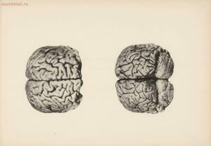 Атлас большого мозга человека и животных 1937 год - 01005159259_145.jpg