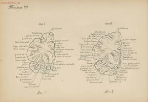 Атлас большого мозга человека и животных 1937 год - 01005159259_156.jpg