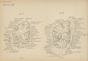 Атлас большого мозга человека и животных 1937 год - 01005159259_160.jpg