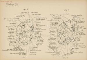 Атлас большого мозга человека и животных 1937 год - 01005159259_168.jpg