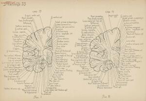 Атлас большого мозга человека и животных 1937 год - 01005159259_172.jpg