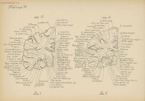 Атлас большого мозга человека и животных 1937 год - 01005159259_176.jpg
