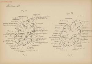Атлас большого мозга человека и животных 1937 год - 01005159259_180.jpg