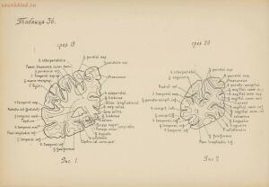 Атлас большого мозга человека и животных 1937 год - 01005159259_184.jpg