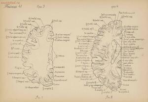 Атлас большого мозга человека и животных 1937 год - 01005159259_200.jpg