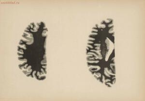 Атлас большого мозга человека и животных 1937 год - 01005159259_201.jpg