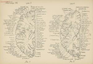 Атлас большого мозга человека и животных 1937 год - 01005159259_204.jpg