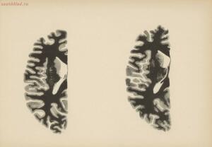 Атлас большого мозга человека и животных 1937 год - 01005159259_205.jpg