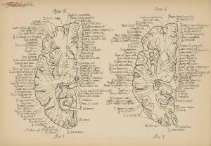 Атлас большого мозга человека и животных 1937 год - 01005159259_212.jpg