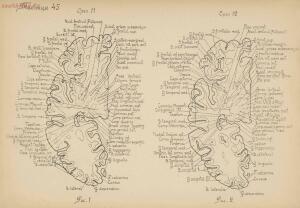 Атлас большого мозга человека и животных 1937 год - 01005159259_216.jpg