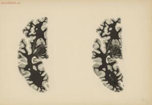 Атлас большого мозга человека и животных 1937 год - 01005159259_217.jpg