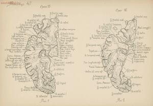 Атлас большого мозга человека и животных 1937 год - 01005159259_224.jpg