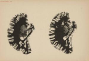Атлас большого мозга человека и животных 1937 год - 01005159259_247.jpg