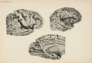 Атлас большого мозга человека и животных 1937 год - 01005159259_257.jpg
